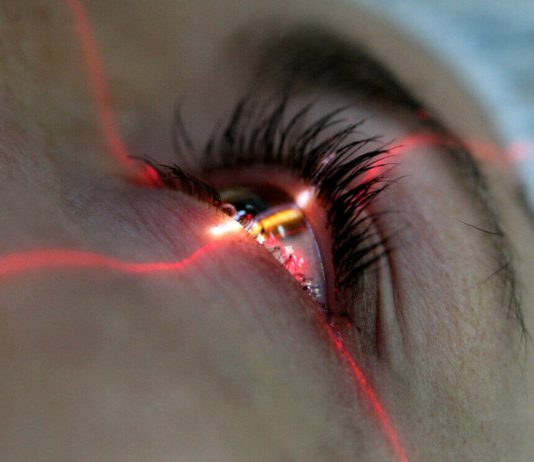 Лазерная коррекция зрения: показания и противопоказания к проведению процедуры