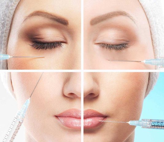 Как филлеры делают людей красивее