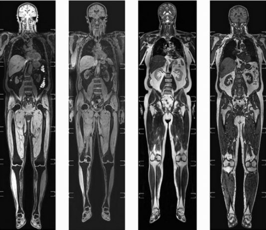 Комплексный подход МРТ всего тела для диагностики заболеваний