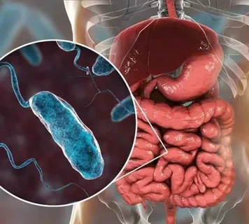 Холера: как распознать угрожающий кризис и остановить его на корню