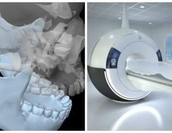 Как проходит МРТ височно-нижнечелюстных суставов: открытый рот и закрытый рот в Рыбацком