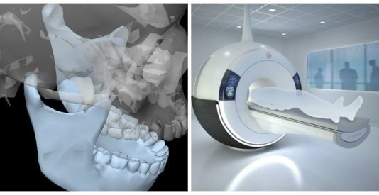 Как проходит МРТ височно-нижнечелюстных суставов: открытый рот и закрытый рот в Рыбацком