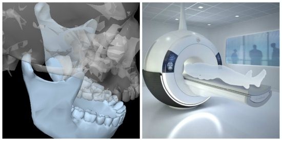 Как проходит МРТ височно-нижнечелюстных суставов: открытый рот и закрытый рот в Рыбацком