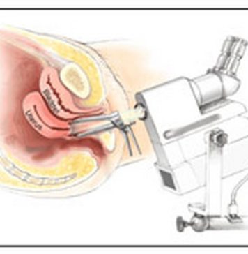 Сколько стоит кольпоскопия и что ещё важно знать перед приёмом