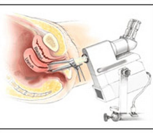 Сколько стоит кольпоскопия и что ещё важно знать перед приёмом