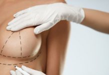 Маммопластика без страха: разумный путь к новой груди