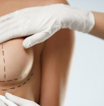 Маммопластика без страха: разумный путь к новой груди