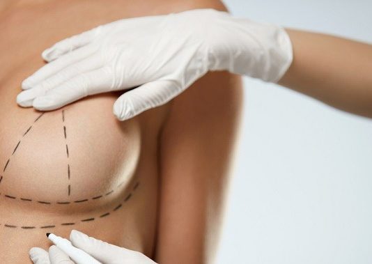 Маммопластика без страха: разумный путь к новой груди