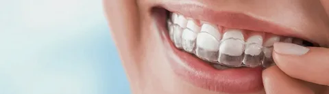 Улыбка без стеснения: современная стоматология глазами человека, который любит жить без боли