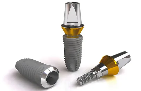 Корейские импланты Dentium: что важно знать перед установкой